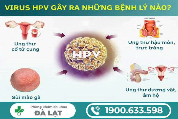 Hình ảnh minh họa